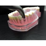 LINDO-LEVIEN Fig: 301