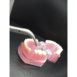 LINDO-LEVIEN Fig: 301