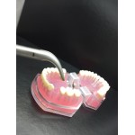 LINDO-LEVIEN Fig: 301