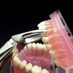 N°7 Prémolaires  supérieures