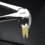 N°13 Devant  inférieur