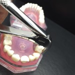 N°13 Devant  inférieur