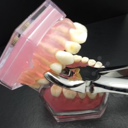 N°18 Molaires  supérieures gauche