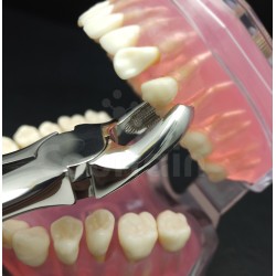 N°17 Molaires  supérieures droit