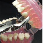 N°17 Molaires  supérieures droit