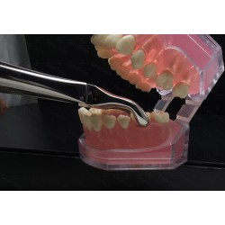 N°79 3-Dents de  sagesse inférieures