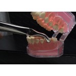 N°79 3-Dents de  sagesse inférieures