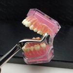 N°67 3-Dents de  sagesse supérieures