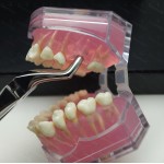 N°51A Racines  supérieures