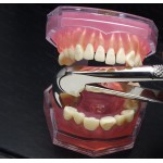 N°33A Racines  inférieures